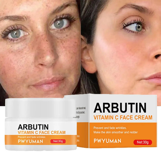 Vitamin C Whitening Moisturizing Face Cream for Melasma Melanin Dark Spots Acne Marks