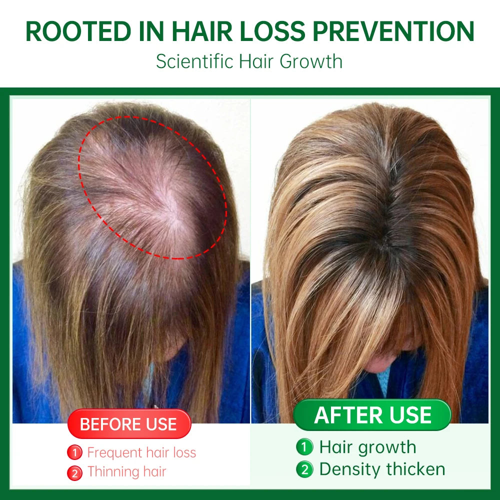 Rosemary Ginger Coconut Oil for Hair Growth