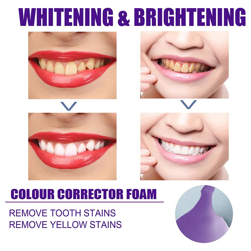 Teeth Whitening Toothpaste Stain Remover