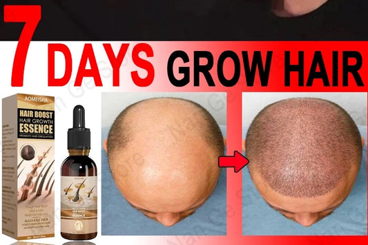 Unisex Hair Growth Oil Hair Loss Treatment Rapid Hair Growth Effective Baldness Repair Hereditary Postpartum Hair Loss