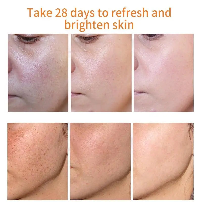 Dark Spots Freckle Melasma Corrector